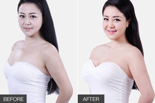 ���ݾS������¡��