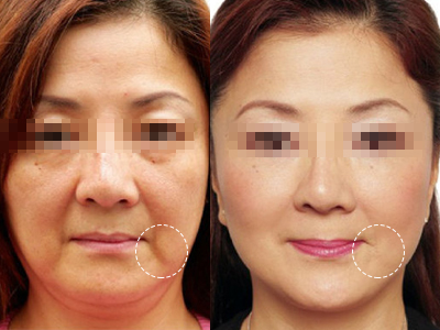 ���ݾS�����������ഺ����