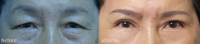 杭州維多利亞美顏新品發(fā)布