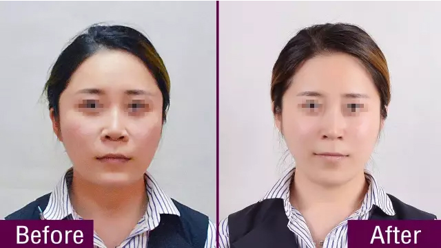 ���ŵǰ���