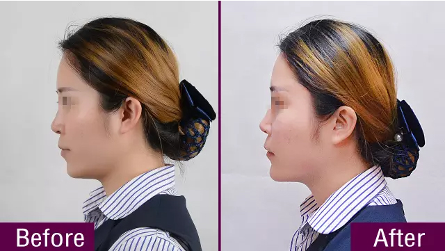 ���ŵǰ���